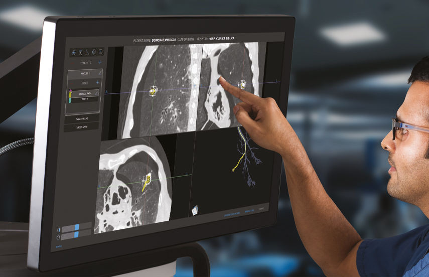 low-dose ct scans