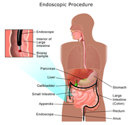 Endscopic Procedure